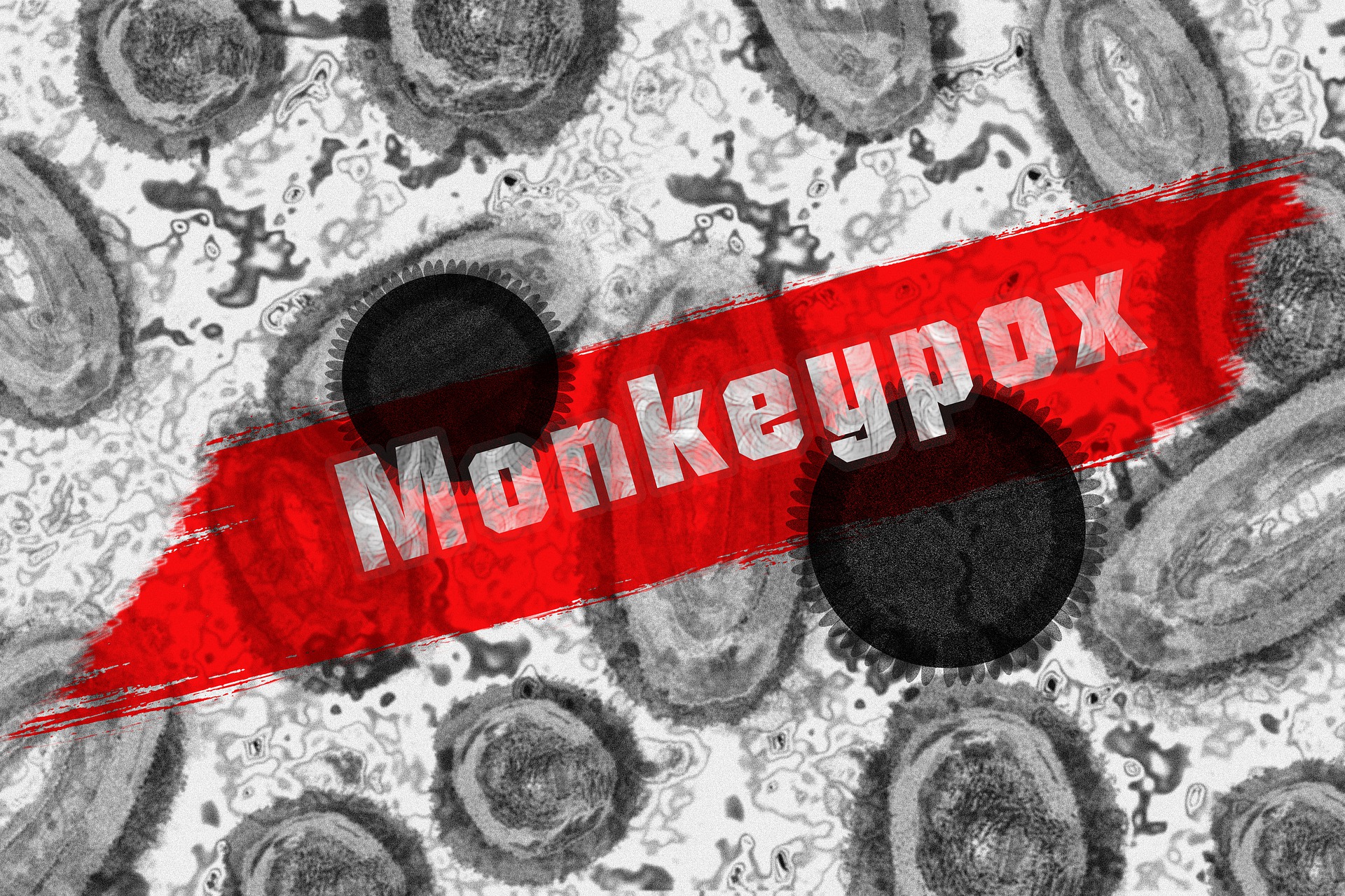 India reports four cases of Monkeypox virus